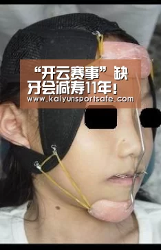 “开云赛事”缺牙会减寿11年!半年内要及时修补(图4) 开云平台
